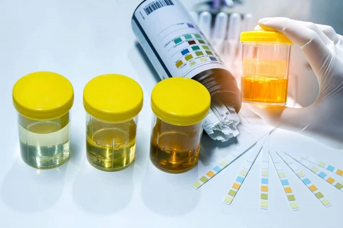 Nước tiểu được hình thành như thế nào?