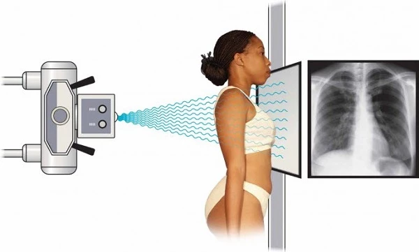 Tại sao dùng tia X có thể chẩn đoán được bệnh trong cơ thể người?