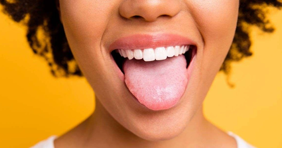 Vì sao lưỡi, môi khi bị răng cắn sẽ lành mau hơn những chỗ khác?