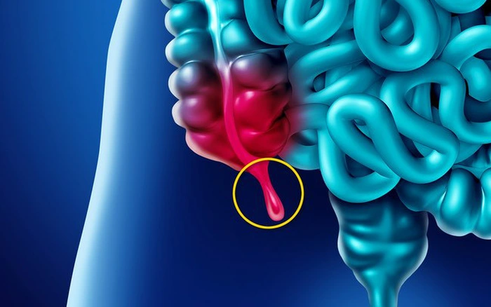 Có phải ruột thừa là phần thừa của cơ thể?